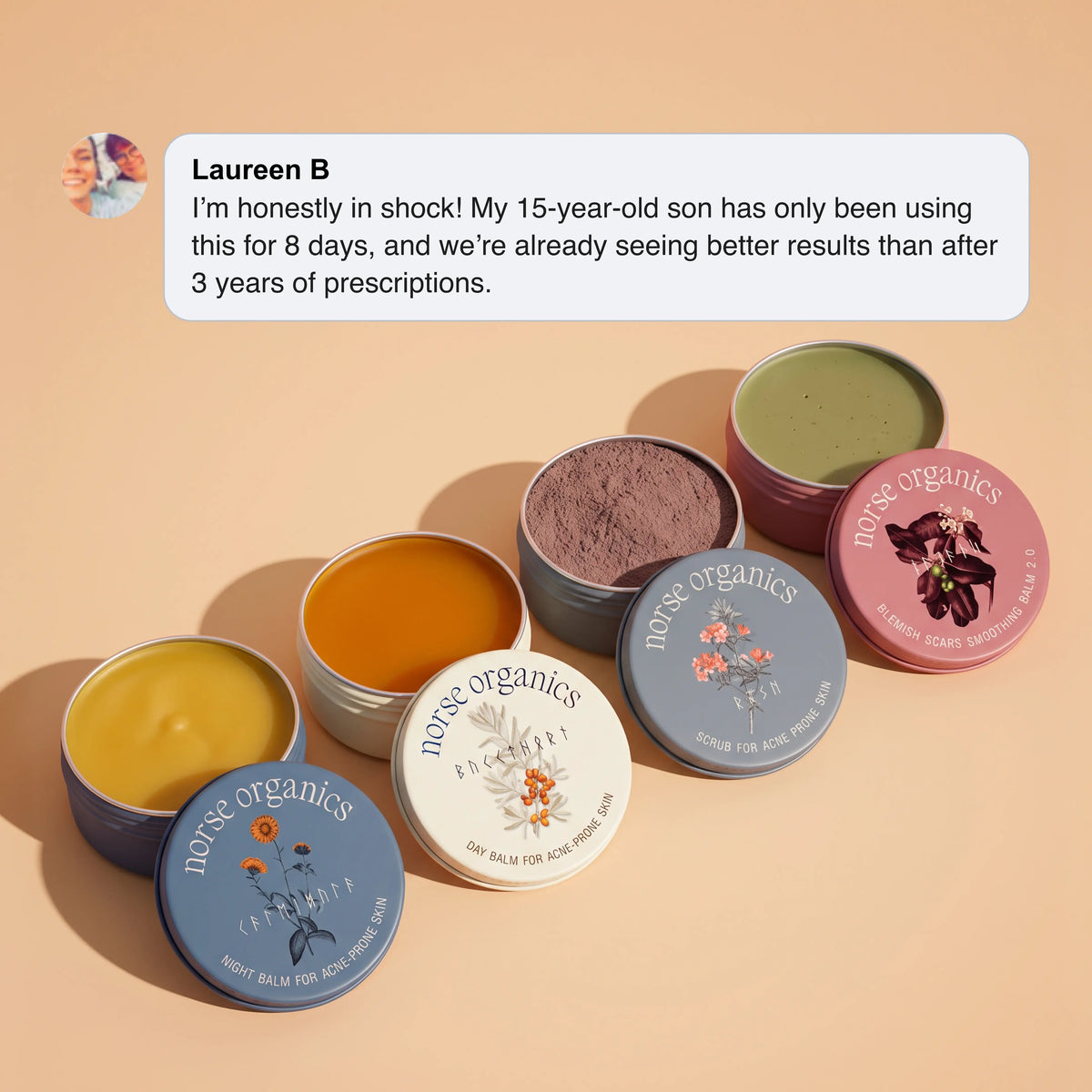 The Complete System for Acne-Prone Skin 2.0